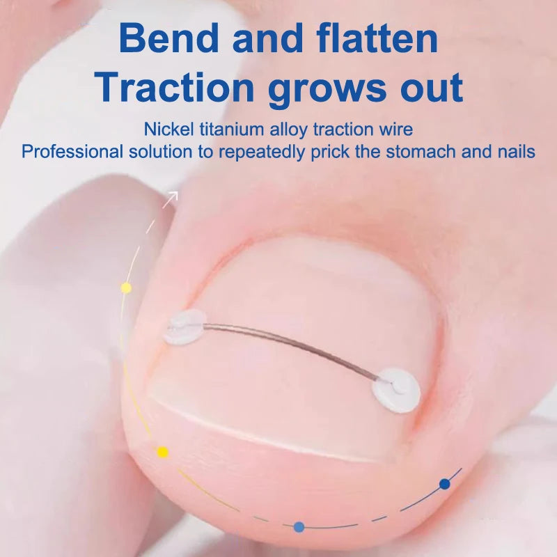 Corrector de Uñas - Liynza