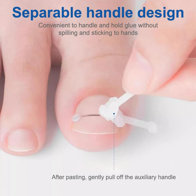 Corrector de Uñas - Liynza