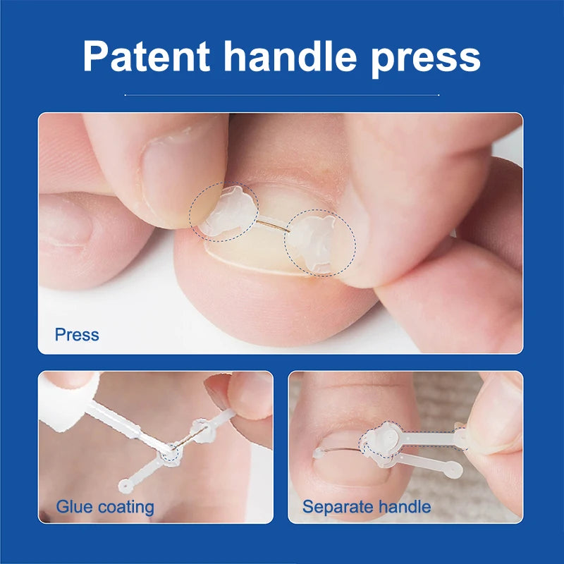 Corrector de Uñas - Liynza