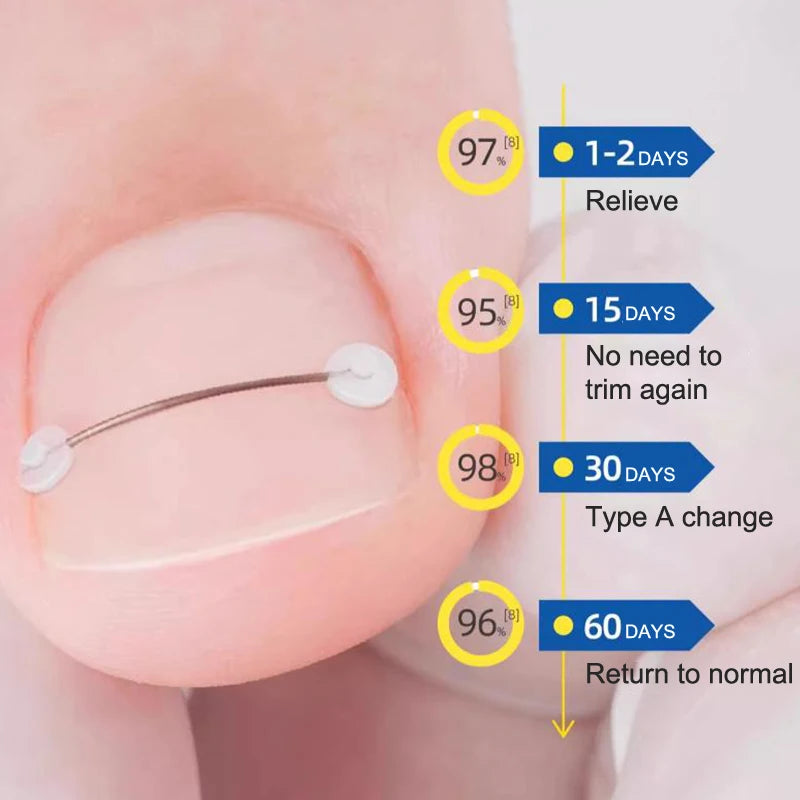 Corrector de Uñas - Liynza